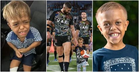 Quaden Bayles Bullied Australian Boy With Dwarfism Lands Role In New