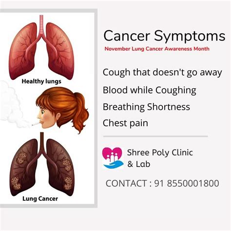 Coughing Blood Lung Cancer