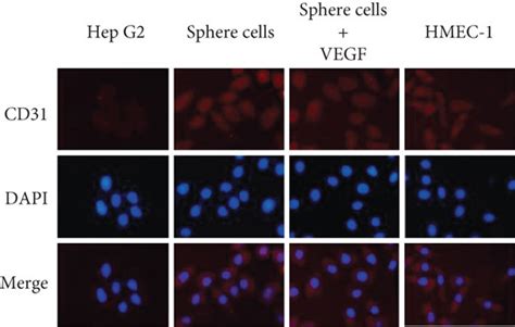 Cancer Stem Like Sphere Cells Differentiate To Endothelial Cells Cells