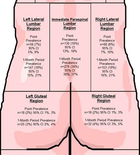 The primary role of the abdominal muscles is to oppose the strong pull of the lower back muscles in order to maintain a normal lumbar spine curve. Prevalence of low back pain by anatomic location and ...