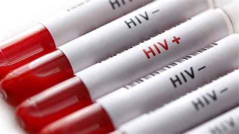 Cure For Hivaids Hiv Antibody Research At Plantform Gets Funding From