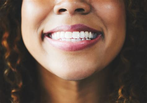 Five Ways Neglecting Your Teeth Can Cost You In Money And In Health Minnesota Spokesman Recorder