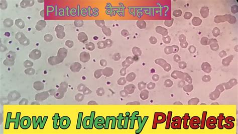 How To Identify Platelets Count Platelets Under Microscope Youtube