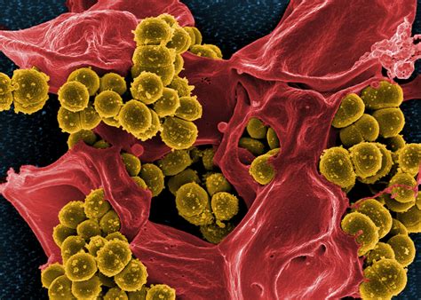 Mikroskopische Aufnahme Von Methicillin Resistenten Staphylococcus