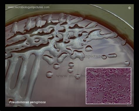 Mucous Colonies Of Pseudomonas Aeruginosa Encapsulated Strain Of