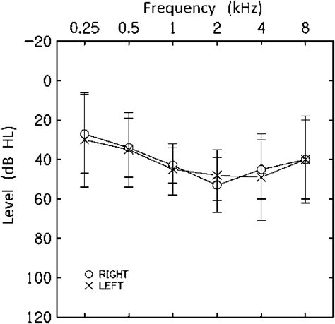 Average Hearing Thresholds 61 Sd As A Function Of Frequency For The