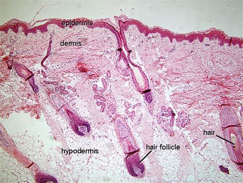 Normal Hair Follicle Histology