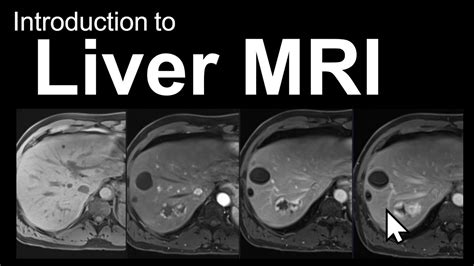 Introduction To Liver Mri Approach And Case Based Course Youtube