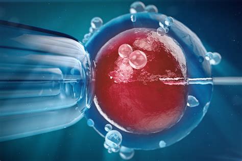 3d Illustration In Vitro Fertilisation Injecting Sperm Into Egg Cell