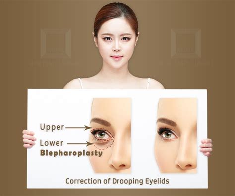 Blepharoplasty Korea Lower And Upper Eyelid Blepharoplasty Surgery