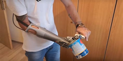This Prosthetic Hand Works Without Electronics Costs Just 30 In Parts