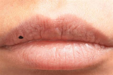 10 Things Your Lips Are Trying To Tell You About Your Health Page 3
