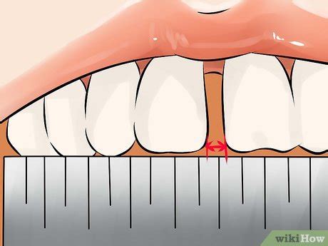 When you do this without fail, you will start to notice the gap close after several nights. How to Get Rid of Gaps in Teeth: 14 Steps (with Pictures)