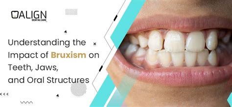 Understanding Bruxism Causes Symptoms And Impact Smilesage