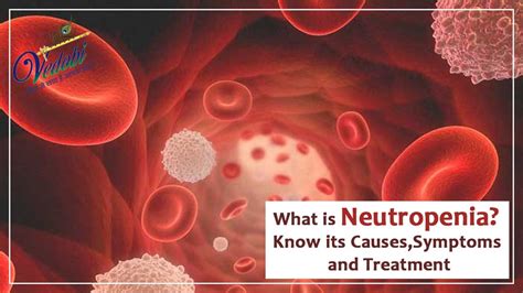 Vedobi What Is Neutropenia Know Its Causes Symptoms And Treatment