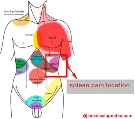 Spleen And Kidney Pain Spleen Or Kidney Pain Bopha