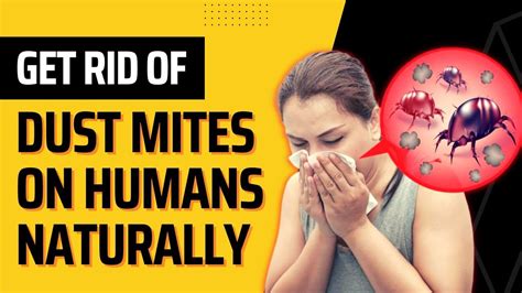 How To Get Rid Of Dust Mites On Humans Naturally Fast Home Remedies