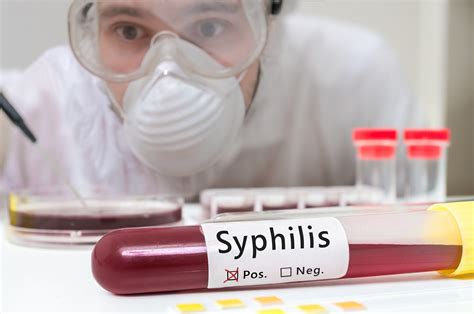 Congenital Syphilis Is On The Rise The Pulse