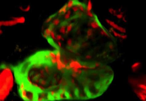 The heart is asymmetrical, with the left side being larger than the right side, correlating with the different sizes of the pulmonary and systemic circuits (figure 11.10). Star role for 'Wars2' gene in heart disease risk ...