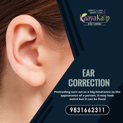 Ear Correction Surgery In Kolkata Cosmetic Surgery Cosmetics Laser
