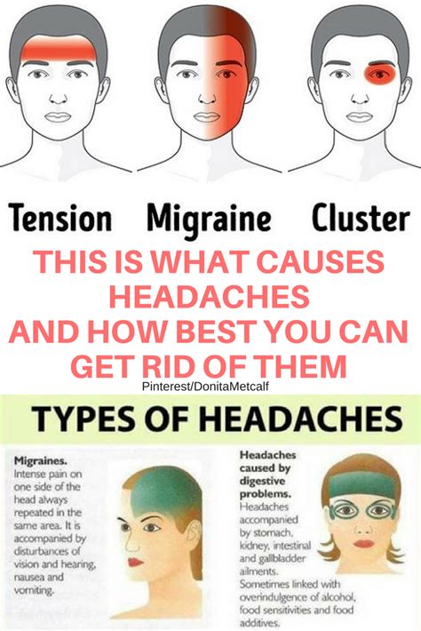Headache Types Causes Medication How To Relief