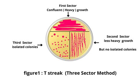 Streak Plate Method Principal And Types Rbr Life Science