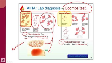 Hematology 2 U1 L11 Coombs Test Youtube