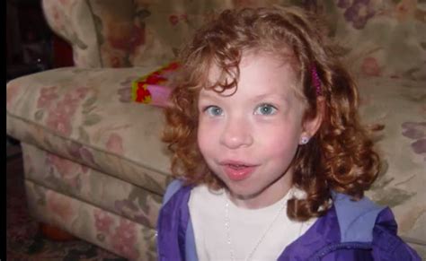Williams syndrome (ws) is a genetic disorder that affects many parts of the body. Williams Syndrome - Pictures, Symptoms, Treatment, Causes ...
