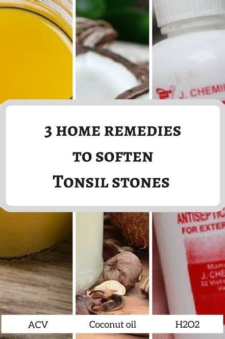 Are Tonsil Stones Hard Or Soft When You Touch Them