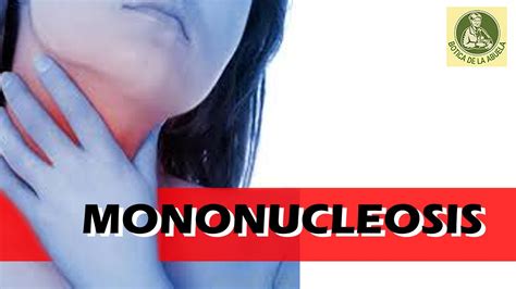 Mononucleosis O Enfermedad Del Beso Remedios Caseros Par La