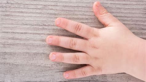 Occurence Of Sausage Fingers Here Are 7 Possible Reasons Behind It