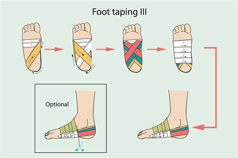 4 Ways Of Taping Your Foot Plantar Fasciitis Or Foot Arch Support