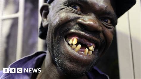 Zimbabwe S Mr Ugly Contest Winner Too Handsome BBC News