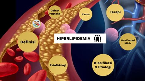 Hiperlipidemia Co To Jest Rodzaje Przyczyny Objawy Leczenie I The