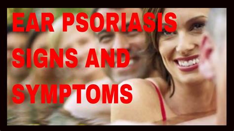 Ear Psoriasis Signs And Symptoms Youtube
