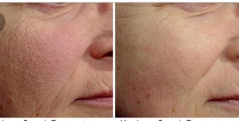 Dermatologist Cincinnati Dr Porras Skin Diagnostics Laser And