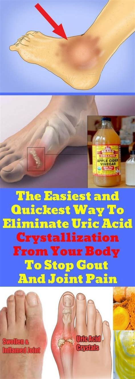 Pin On Uric Acid