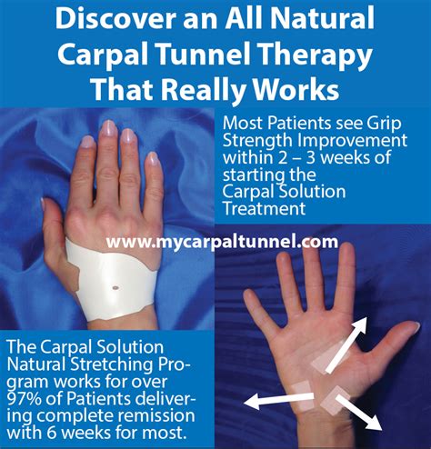Carpal Tunnel Therapy All Natural Over 97 Success Rate