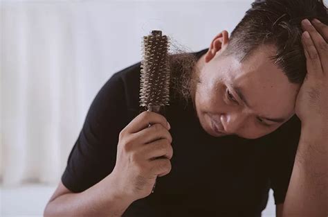 6 Cara Mengatasi Rambut Rontok Pada Pria