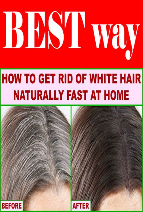 How To Get Rid Of White Hair With Naturally Fast At Home White Hair