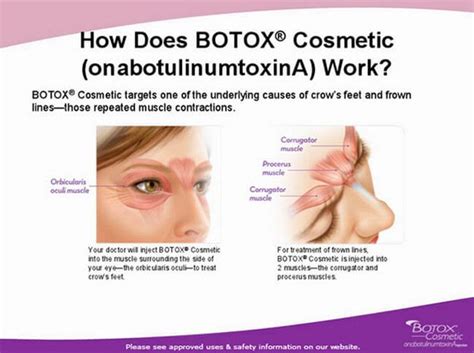 Click here to learn more. Botox | Dr WW Med Spa & Laser Center