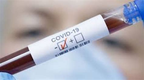 A diagnostic test can show if you have an active coronavirus infection. Former Test cricketer tests negative for COVID-19