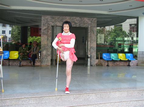 One Leg Amputee Woman Crutches Rose Petra