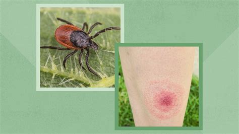 How Ticks Can Make You Sick Plus Photos Of Different Types Of Ticks