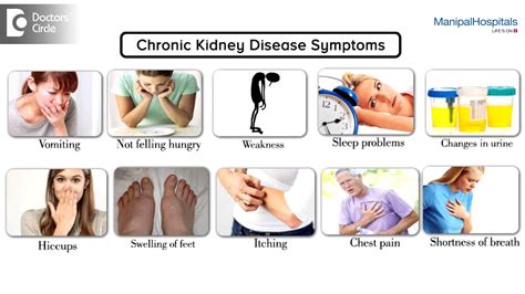 Initially there are generally no symptoms; What are the symptoms of Chronic Kidney Disease | Health ...