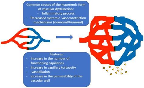 Diagnostics Free Full Text Myalgic Encephalomyelitis Chronic