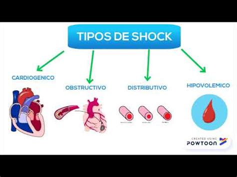 Shock hipovolémico se produce cuando los órganos y tejidos del organismo no reciben un aporte ⌚ 4 minutos | el shock hipovolémico es un tipo de shock que se produce como resultado de una. Shock hipovolemico. Patologia Quirurjica - YouTube