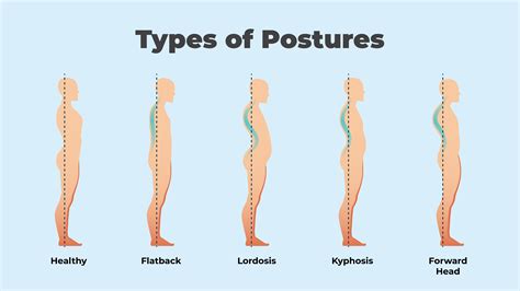 Types Of Posture How To Fix Bad Posture With Ergonomic Office Chairs Ergomeister