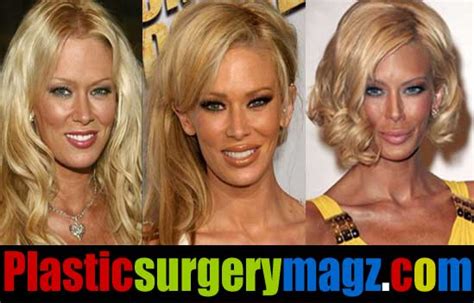 Jenna Jameson Plastic Surgery Before And After Plastic Surgery Magazine