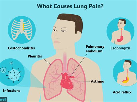 Muscle pain (myalgias) chemotherapy side effect, causes, symptom management and when to contact your healthcare provider during cancer treatment. Back Muscle Pain Chart / Referred Pain Active Muscle And ...